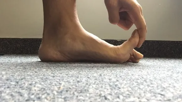 Hallux Rigidus: How Your Big Toe Affects All Movement - MOTIVNY NYC Physical Therapy & Training